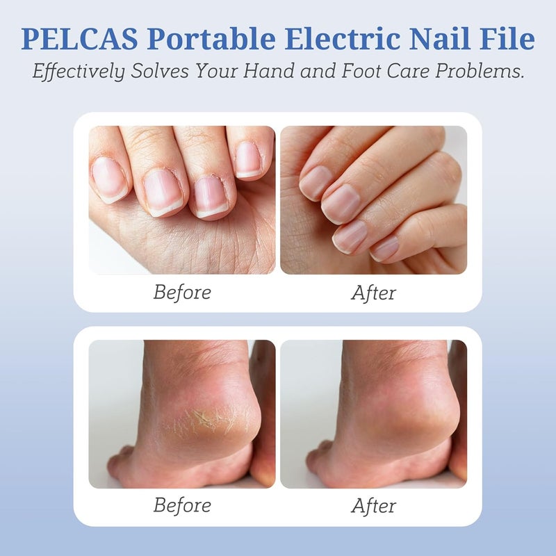PELCAS Electric Nail File, 5 Speeds Manicure and Pedicure Kit, Cordless Nail Drill, Toenail Grinder for Thick Toenails with LED Light, Dremel Tool Kit for Human, Pet, Toenails, Natural & Acrylic Nails - Image 2